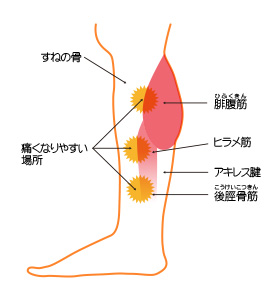 シンスプリント